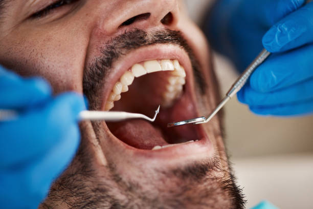 Best Emergency Cosmetic Dentistry (e.g., broken veneers) in Dillsboro, IN