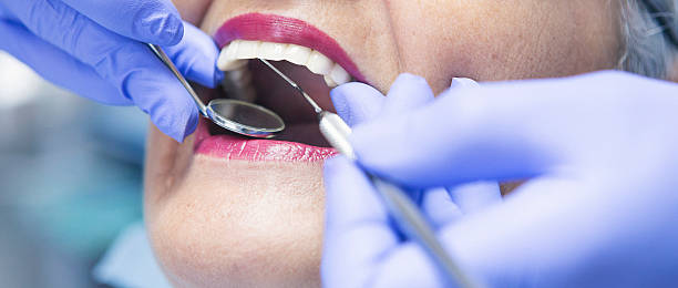 Best Walk-In Emergency Dental Services in Dillsboro, IN
